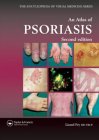 Atlas of Psoriasis (Encyclopedia of Visual Medicine)